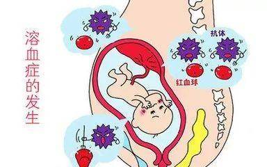 妈妈o型血,爸爸a或b,宝宝真的会溶血性黄疸吗?严重到要换血?