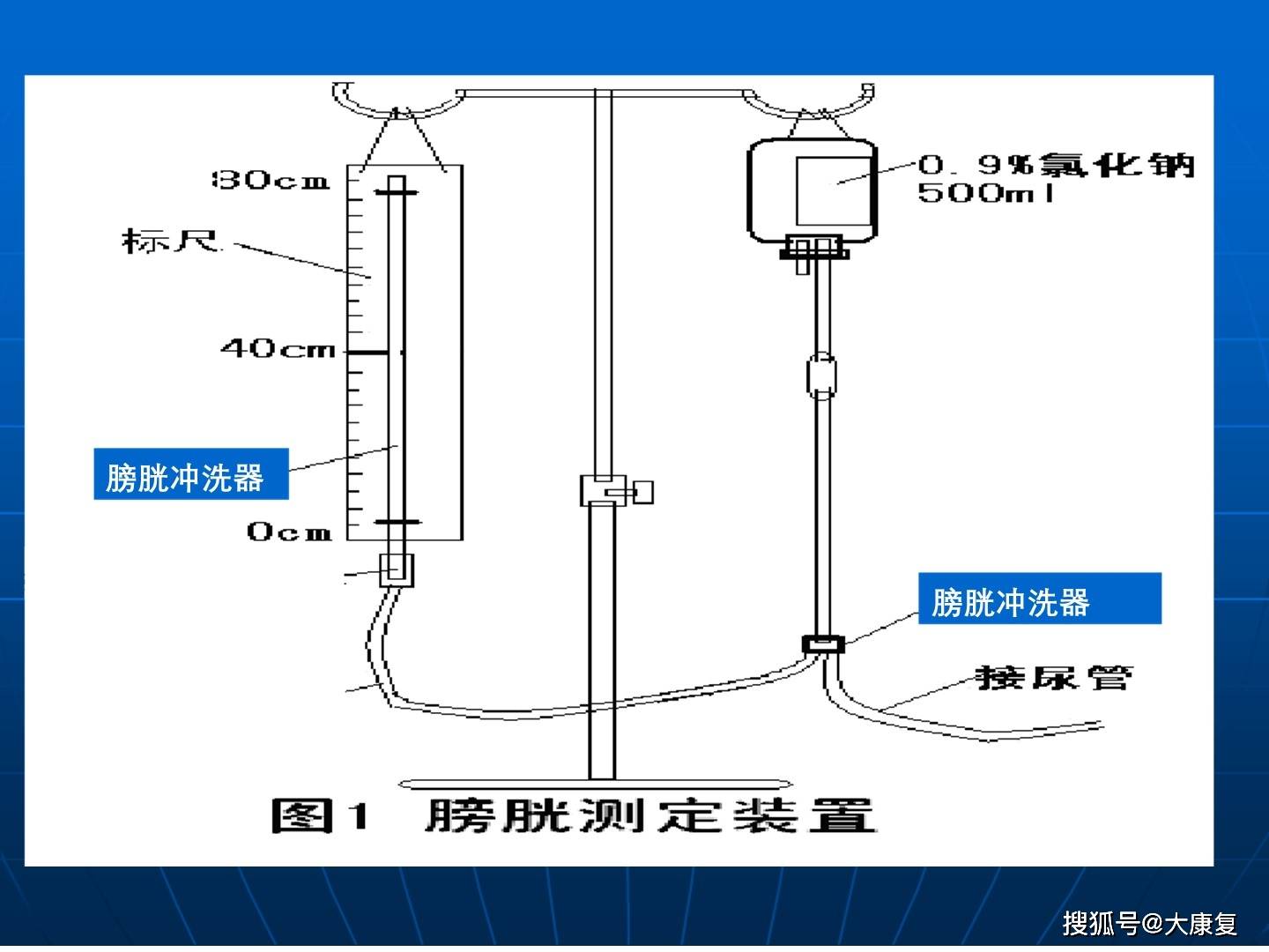 膀胱容量与压力测定