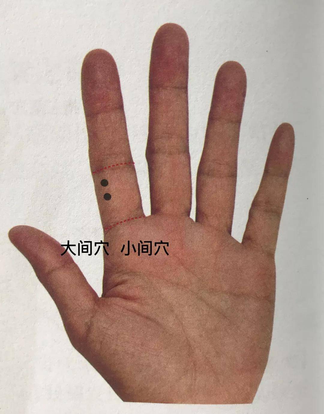 董氏奇穴每日一穴大间穴小间穴
