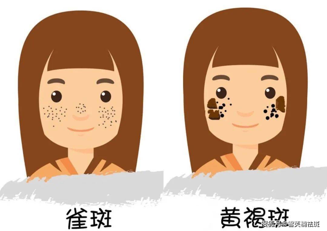 如何淡斑祛斑小妙招教你简单实用的美白祛斑小妙招
