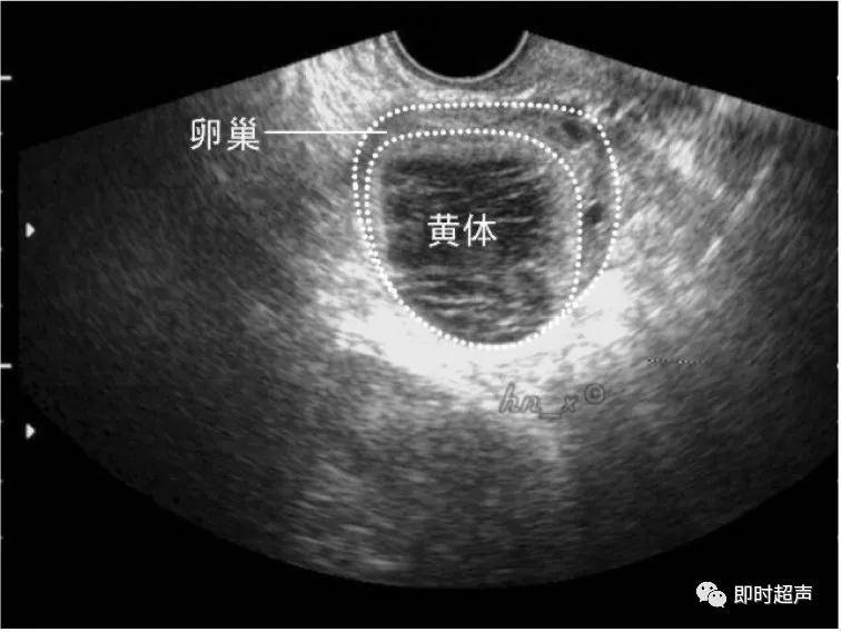 卵巢彩超表现:经阴道扫查可较准确评价卵巢血供情况.