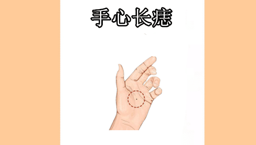 在相学当中,若是一个人的腋窝处的位置长有吉痣,则会被称之"金匮痣"