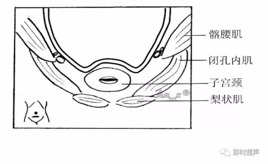 图2-4-2 经子宫颈横切面盆腔内结构示意图  来源:即时超声 返回搜