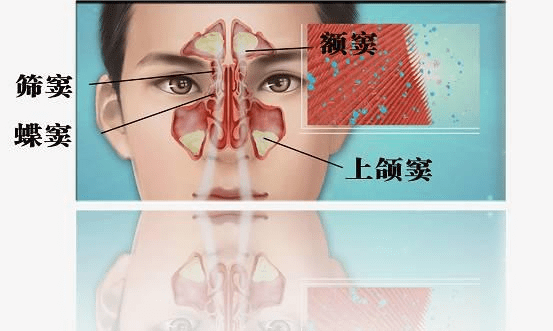 贵阳铭仁耳鼻喉医院:筛窦炎有哪些症状?如何预防?答案全在这里!