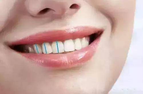 你的牙齿美丽吗?口腔专家告诉你,洁白的牙齿可不算哦