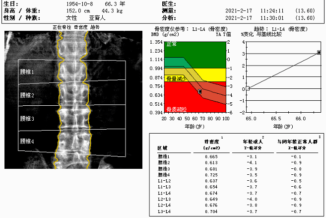 近期袁大妈复查血清骨代谢标志物示ctx明显下降(245.