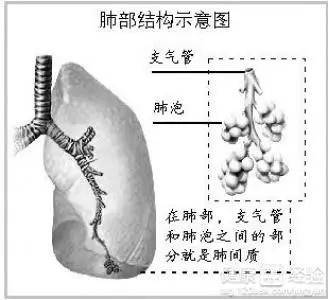 肺间质是肺泡间,终末气道上皮以外的支持组织,包括血管,结缔组织