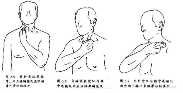 干货| 斜角肌激痛点-上半身疼痛的解决关键_按摩
