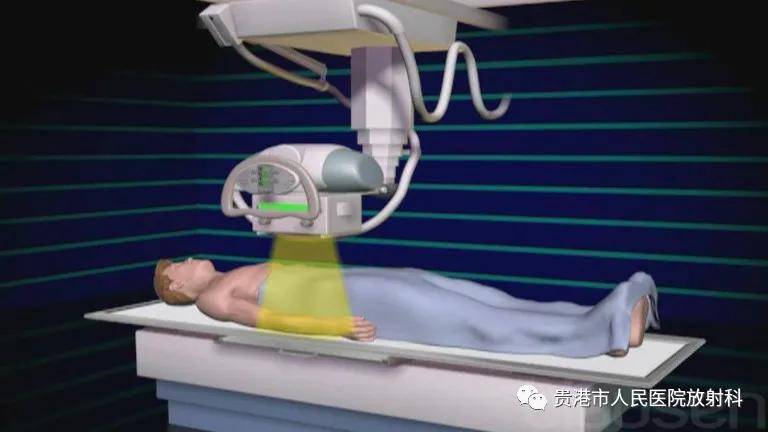 一文读懂"x线"检查那些事