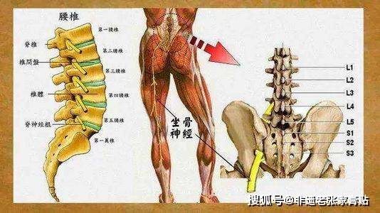 原创非遗老张家膏贴:腰部疼痛,双腿麻木是坐骨神经痛吗?