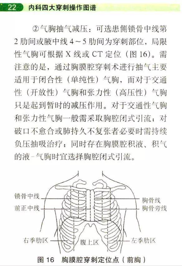 内科四大穿刺操作图谱