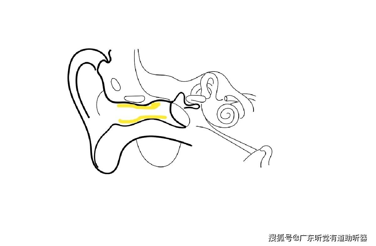 怎样判断耳朵有没有盯眝?