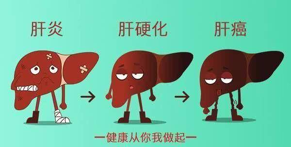 放屁多就是肝硬化吗乙型肝炎病人频繁放屁好吗