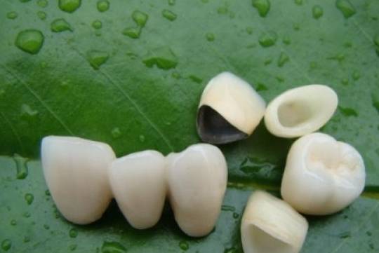 临时牙套已戴一个月,基牙根部变色,装全瓷牙怎样处理?