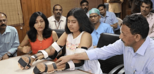 印度女孩因车祸导致双臂截肢,移植黑人手臂,2年后肤色