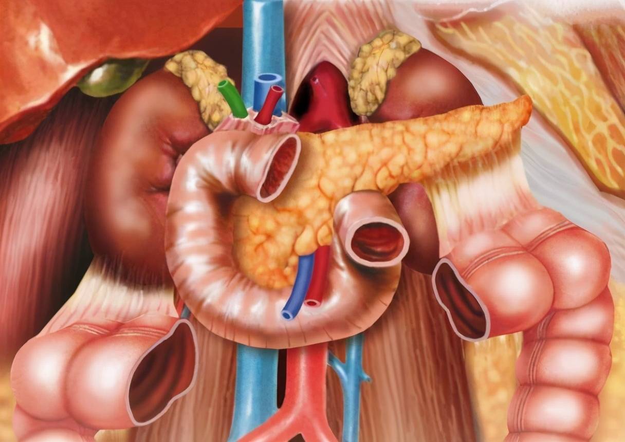 原创胰腺癌查出多是晚期身体早就发出了4个信号很多人忽视了