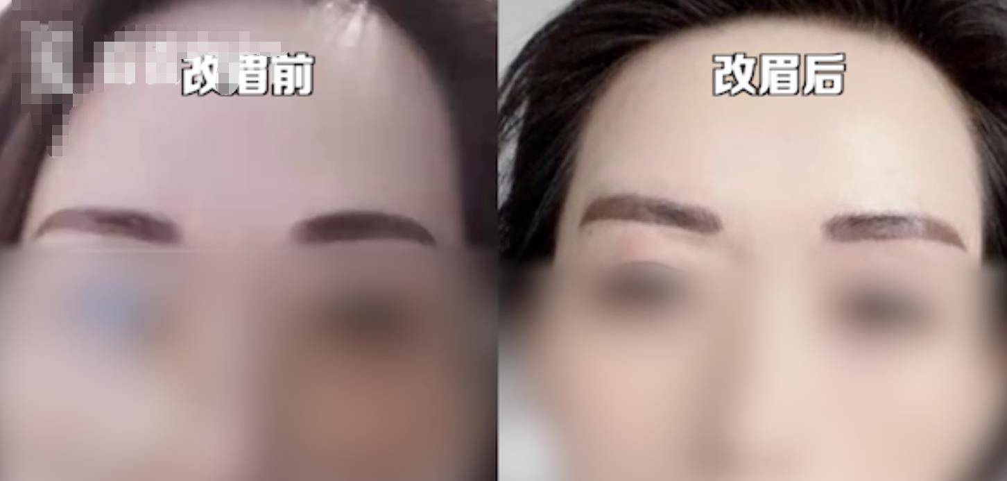 杭州女子花6万纹"风水眉",结果被纹出两把大刀,要把自己丑哭了