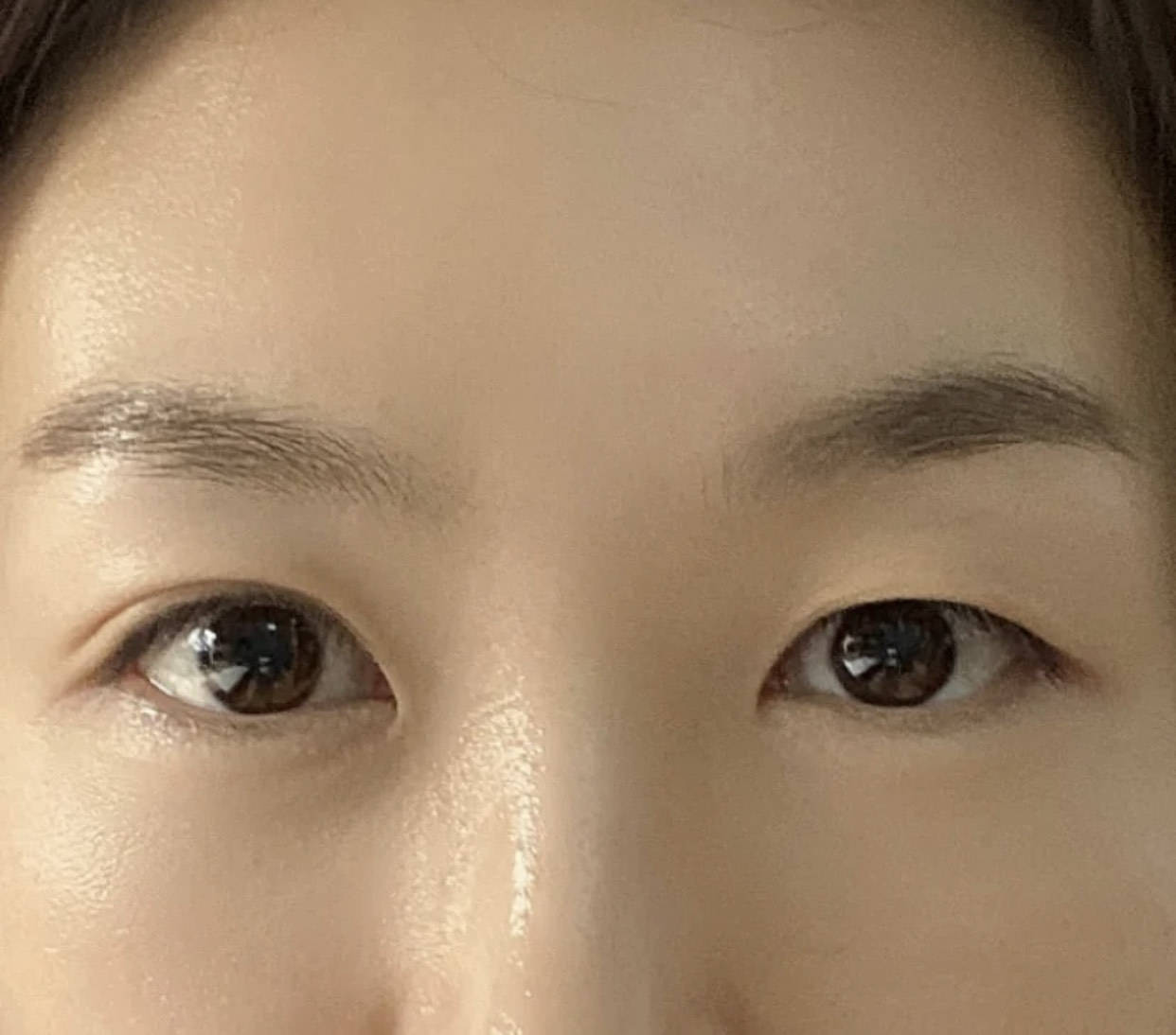 有这几个特征的女生,割双眼皮才会好看!测测你合不合适,别冲动