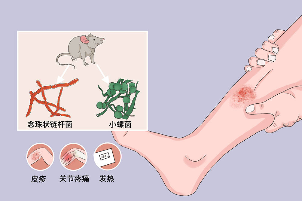 人类对老鼠既恨之入骨又无可奈何老鼠有何特殊本领与人类对抗