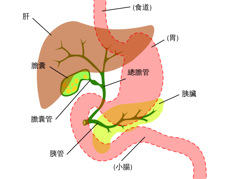 什么是胆管结石竟有肝内肝外之分让专业医生告诉您