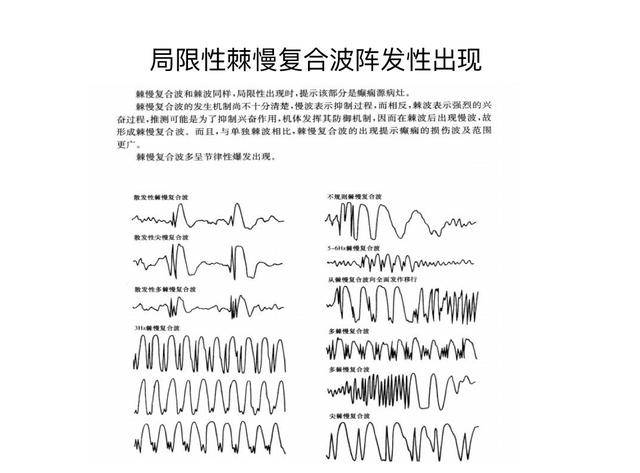 儿童脑电图基础与判读解析