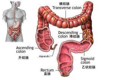 结肠癌大多是"拖"出来的?身体3个迹象,或暗示结肠在"癌变"