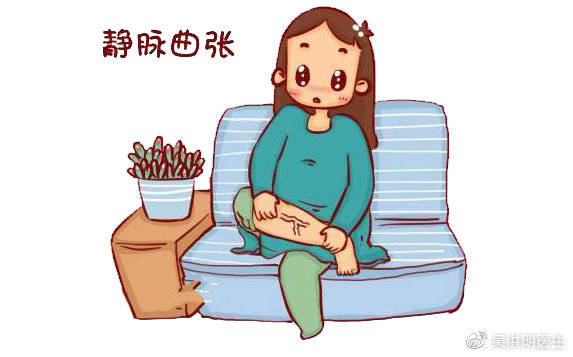 静脉曲张也是可以通过我们的努力预防,缓解的