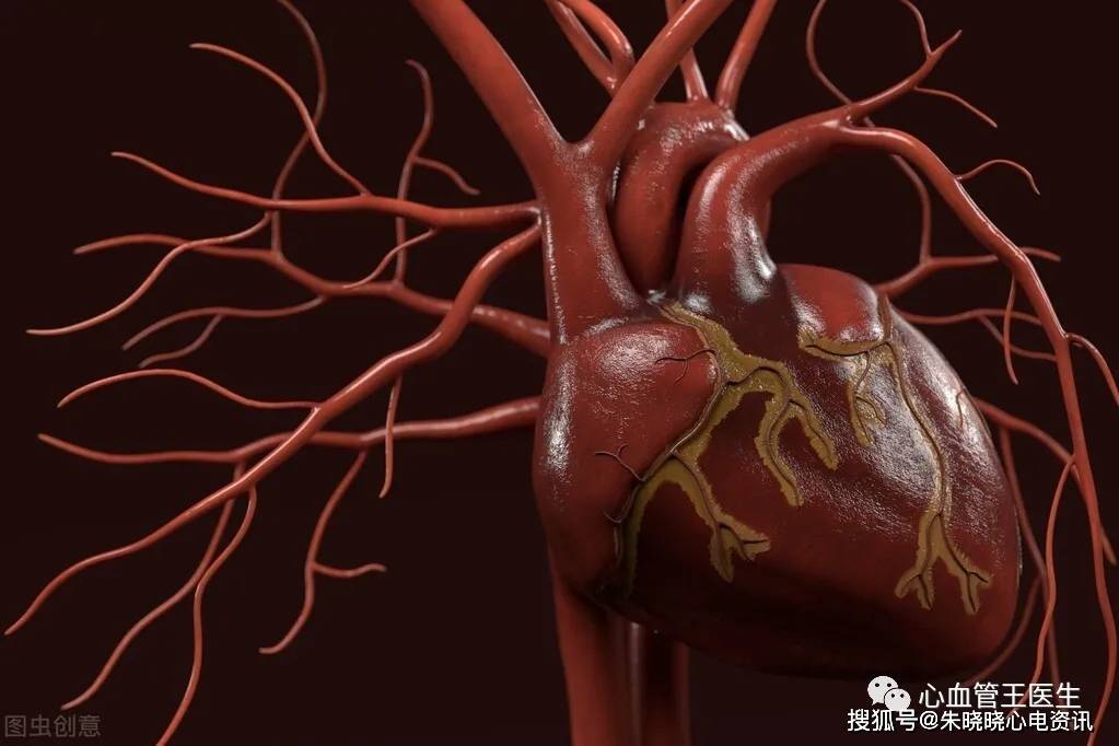 心脏造影有哪些危害和风险?什么样的人才适合做心脏造影检查?