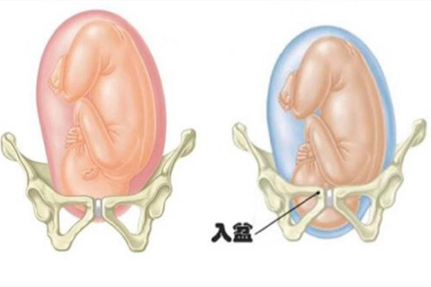 孕晚期胎儿入盆了是啥感觉？肚型有变化,6种表现也不一样了