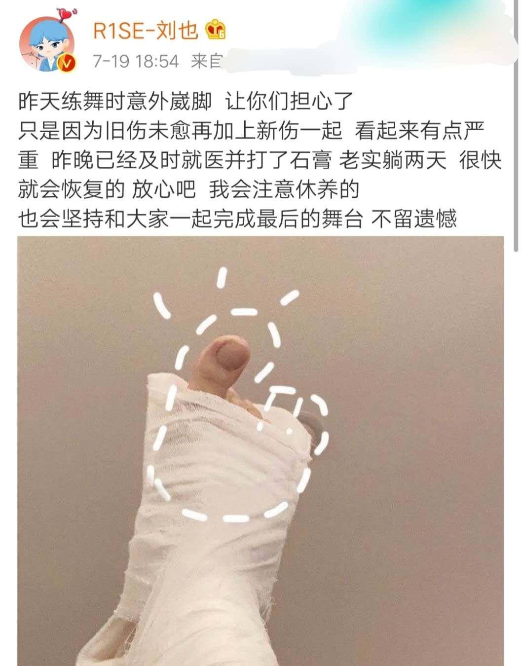 r1se刘也练舞意外崴脚,打石膏向粉丝报平安,还不忘