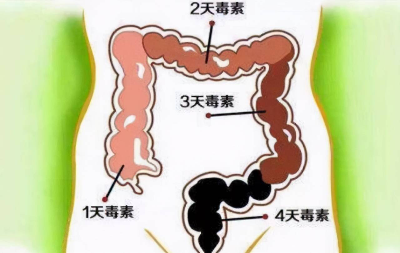 而且便秘常伴有难闻的体味,这是由于毒素在肠道内长久积聚,像下水道