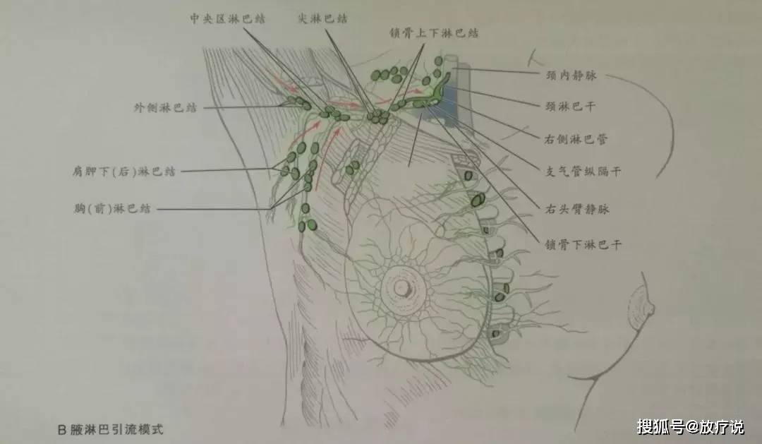 图2 / 红色箭头显示腋窝淋巴结向右侧淋巴管方向引流 3 内乳路线 im