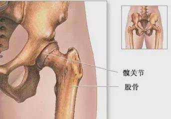 大腿骨插入关节窝