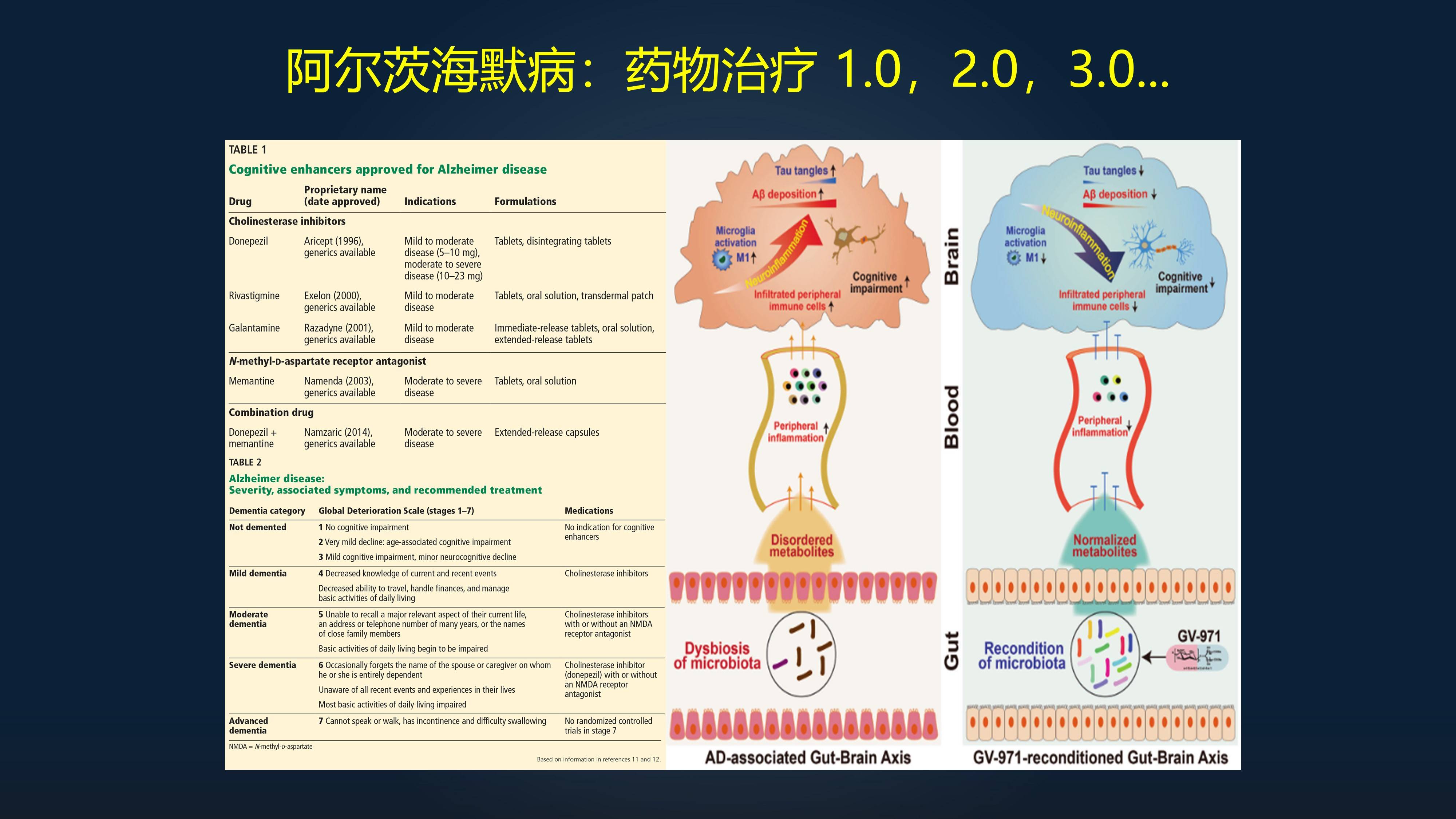 原创徐俊24分钟详解如何诊治阿尔茨海默病