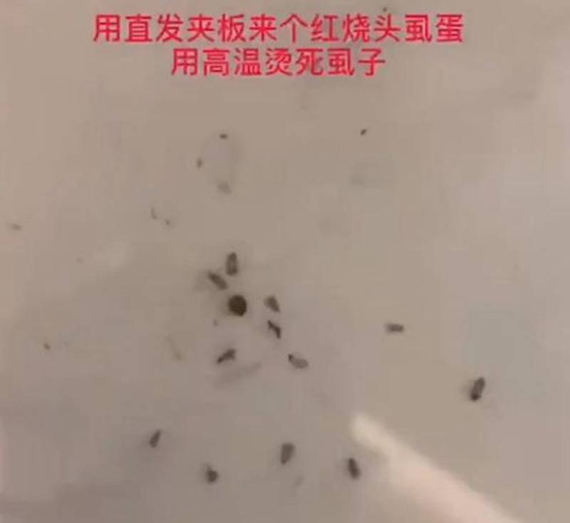 原创女儿住校被染上了头虱,妈妈用了这个方法后,虱子和虫卵被一锅端