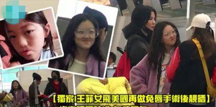12岁李嫣新手术后近照,嘴上看不到疤痕与常人无异,笑起来更自信
