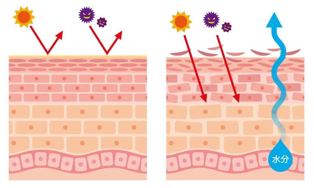 健康的皮肤屏障(左)和受损的皮肤屏障(右)