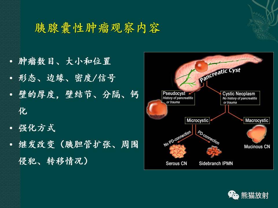 胰腺及脾脏病变影像诊断