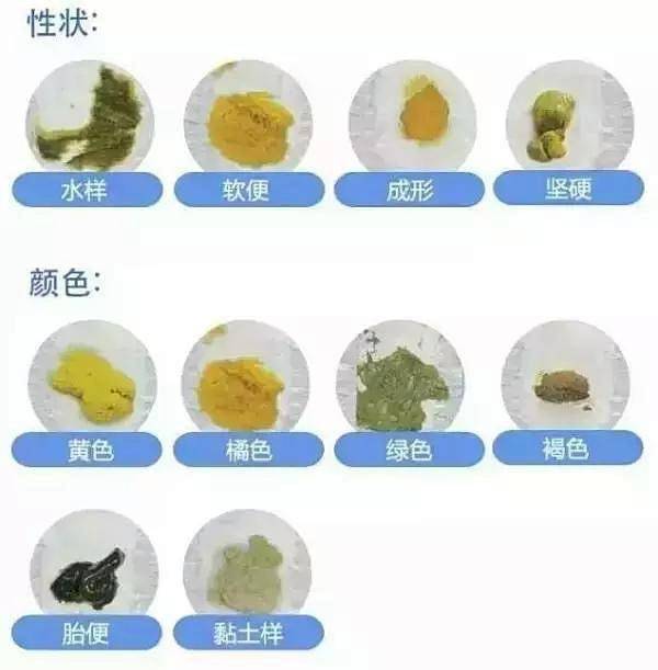 胎便通常没有臭味,状态黏稠,颜色近墨绿色,这也是新生儿的第一次大便