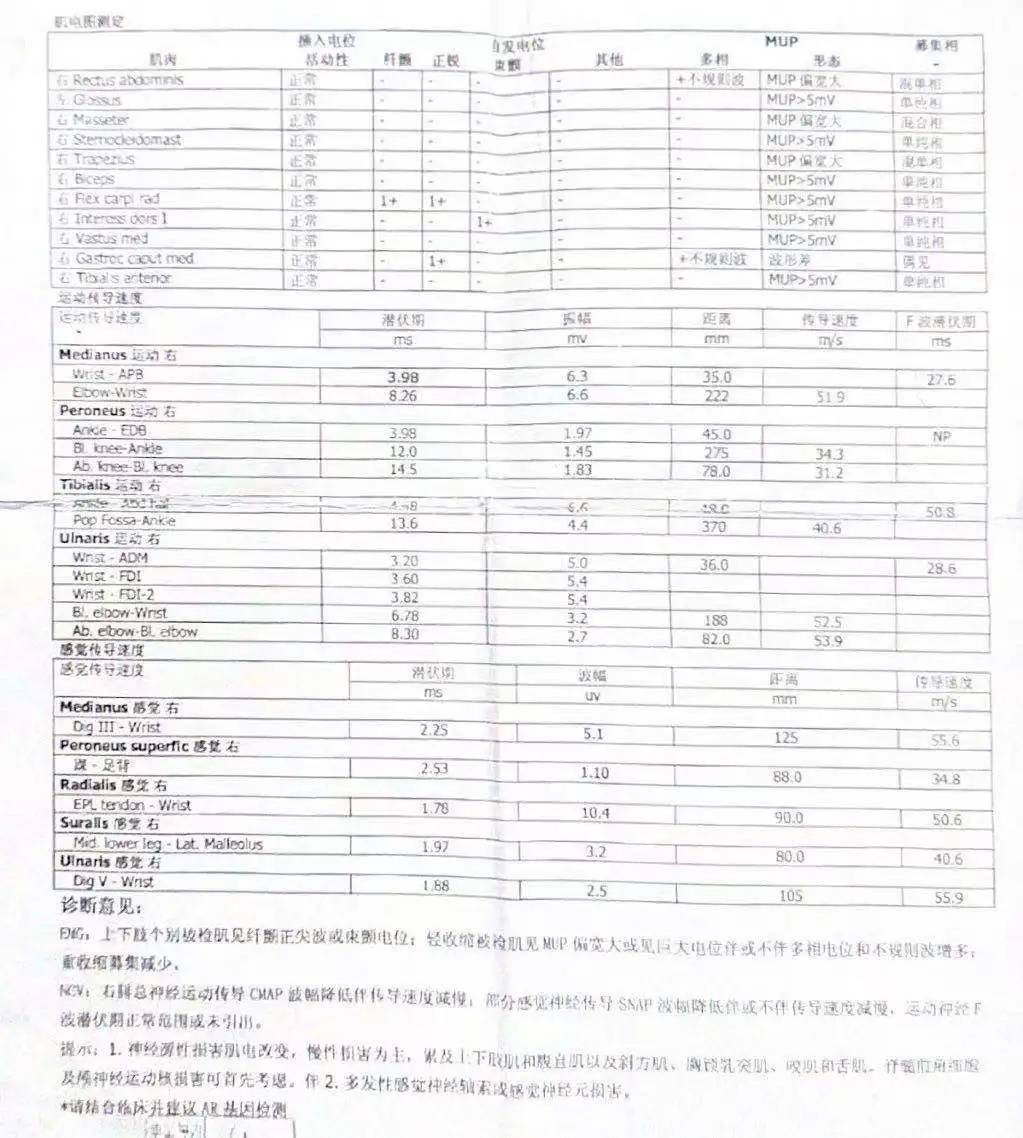 肌电图检查报告结果如下