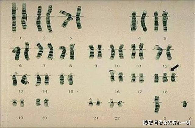 原创男性y染色体不断缩短450万年后可能消失到时还有男性吗