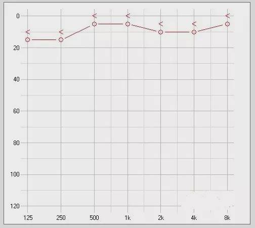 临床上正常听力的听力图显示为:骨导听力在各频率范围中均为0～20dbhl