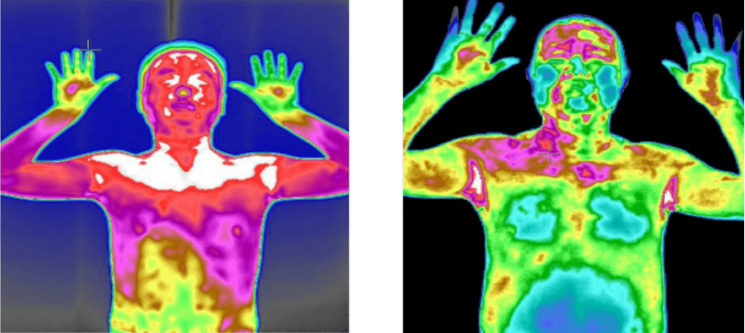 红外热成像技术在心理及情绪方面应用研究分析