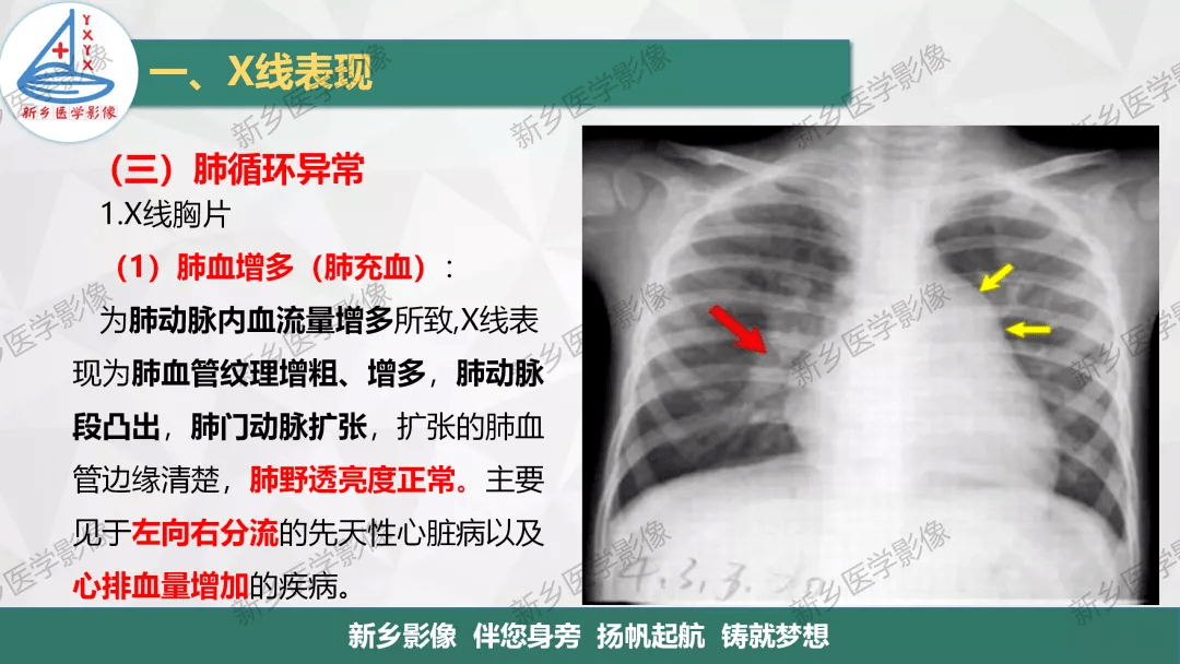 如何在胸片上观察心脏及血管的变化