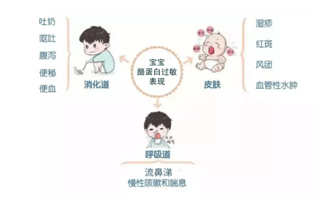 一喝奶就吐奶腹泻便秘除了乳糖不耐受或许罪魁祸首是它
