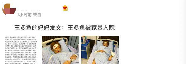 百万粉网红王多鱼被男友家暴面部青紫入院治疗妈妈发文控诉