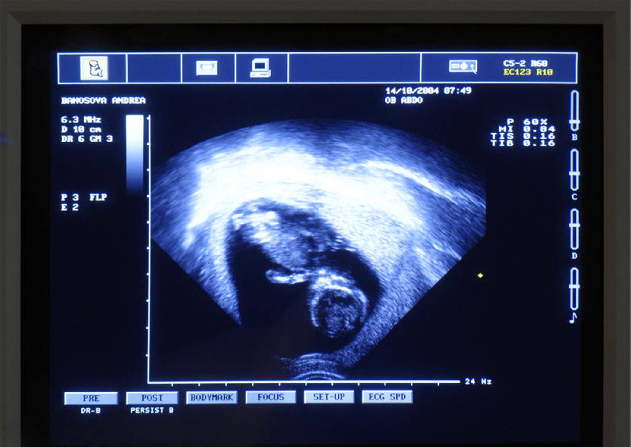 原创b超对孕妇胎儿有害吗孕期做多少次b超合适一文说清