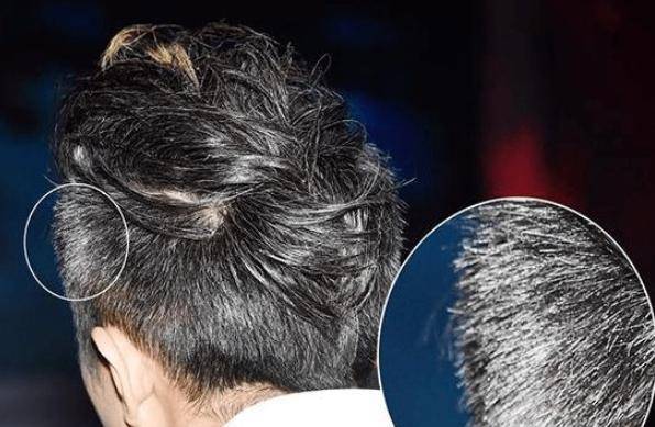 原创白发长在哪病就从哪出长在前额两鬓后脑勺分别说明什么