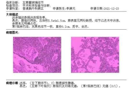 "你要相信光",那么就一定能击败11mm混合磨玻璃结节_妹子_ct_戴主任