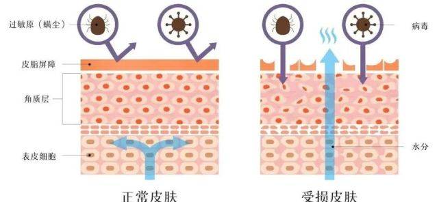 阜阳皮肤病医院皮肤屏障对我们到底多重要